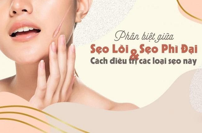 Kem làm mờ sẹo phì đại do tai nạn