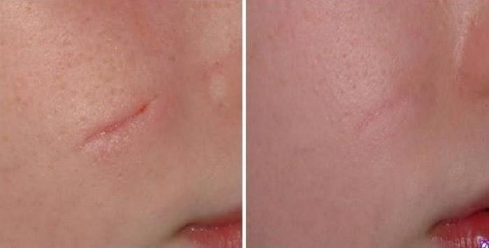 ình ảnh sau khi khách hàng sử dụng. ình ảnh sau khi khách hàng sử dụng.