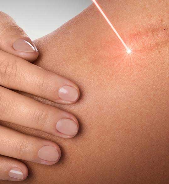 Bức xạ liều thấp