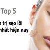 Top 5 kem làm mờ sẹo lồi hiệu quả nhất hiện nay