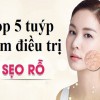 Top 5 kem làm mờ sẹo rỗ được người dùng săn lùng nhiều nhất năm 2020