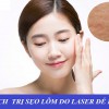 Cách làm mờ sẹo lõm sau Laser hiệu quả và an toàn nhất cho da