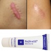 Sử dụng Gel làm mờ sẹo Scar Rejuvasil đúng cách - Yếu tố chính đảm bảo tối ưu hiệu quả