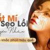 Cách làm mờ sẹo lồi sau khi cắt mí an toàn và hiệu quả nhất hiện nay