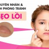 Sẹo lồi: Nguyên nhân và cách điều trị hiệu quả hàng đầu hiện nay