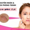 Sẹo phì đại là gì? Nguyên nhân gây ra sẹo phì đại cần biết